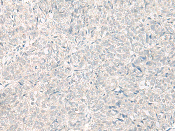 GOLGA5 Antibody