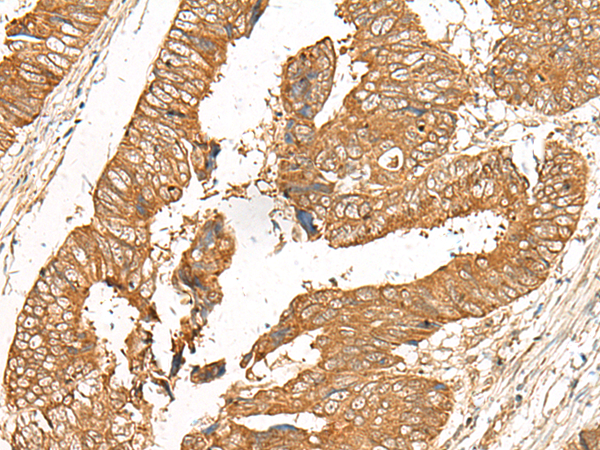 GOLGA6A Antibody