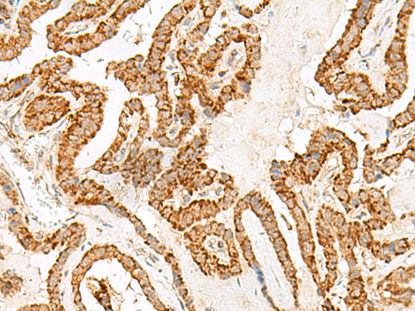 NUP210 Antibody