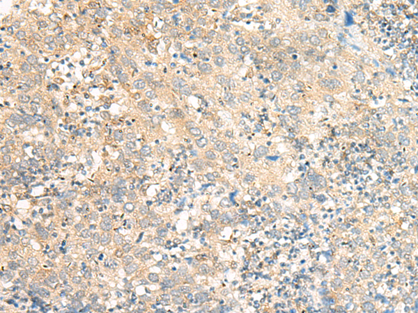 C5AR2 Antibody