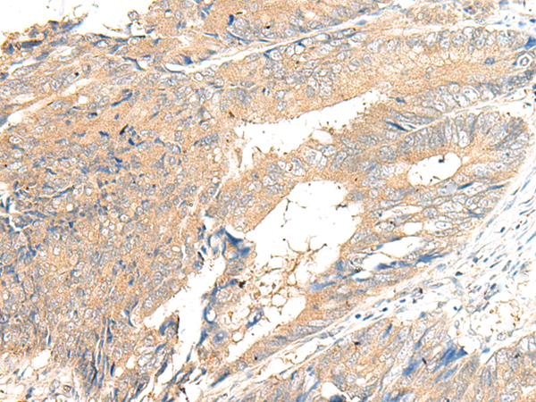 GPR132 Antibody
