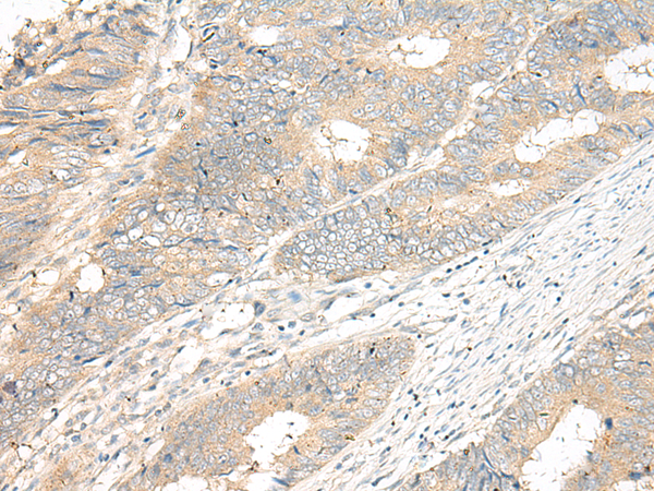 PRLHR Antibody