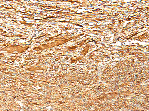 ADGRF1 Antibody