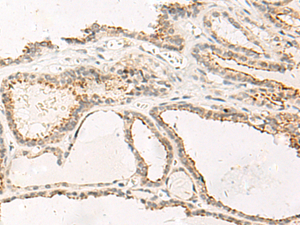 MCHR2 Antibody