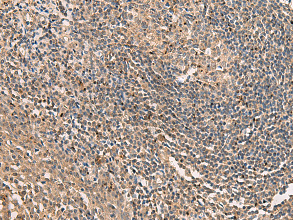 GPR160 Antibody