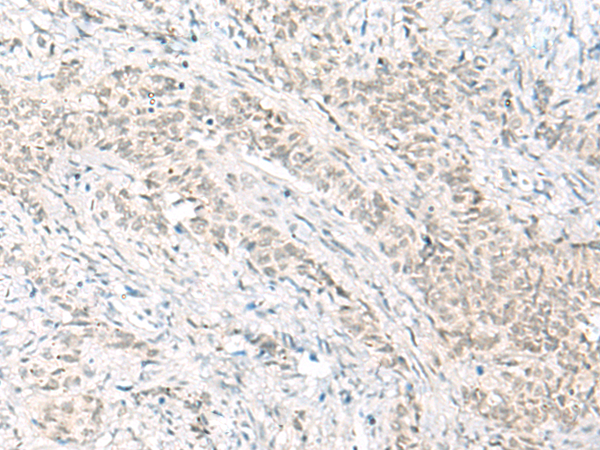 HABP4 Antibody