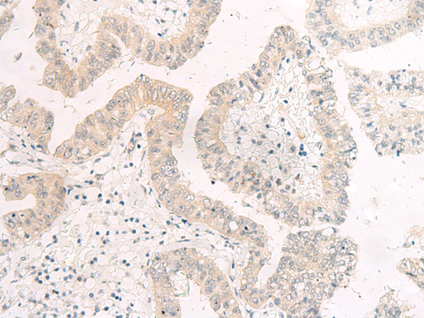 HASPIN Antibody