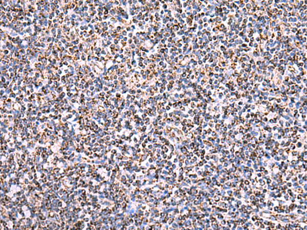HSF2BP Antibody