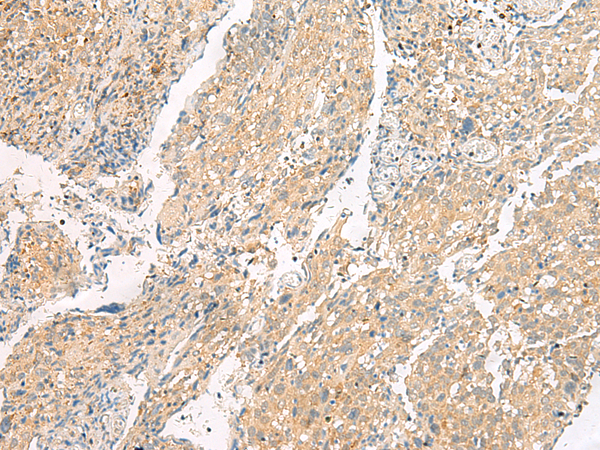 HEBP1 Antibody