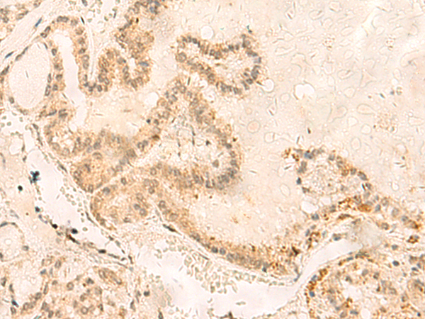 ZNF85 Antibody