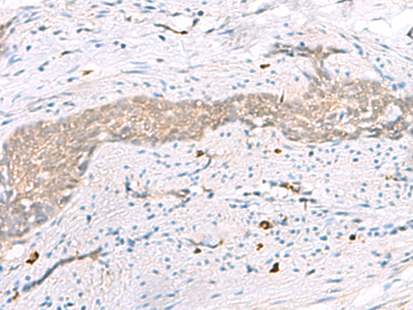 RBM26 Antibody