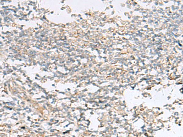 HECA Antibody