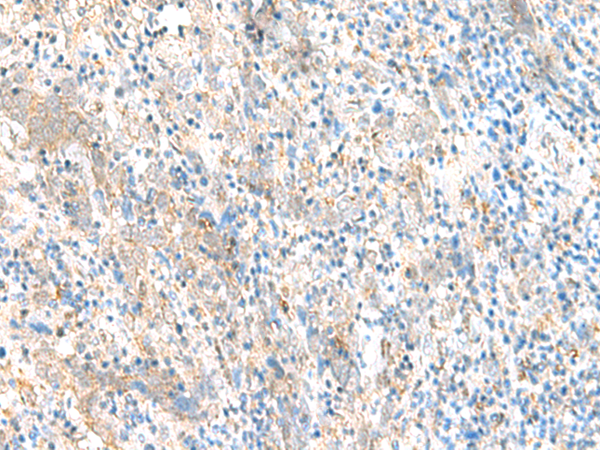 ERI1 Antibody