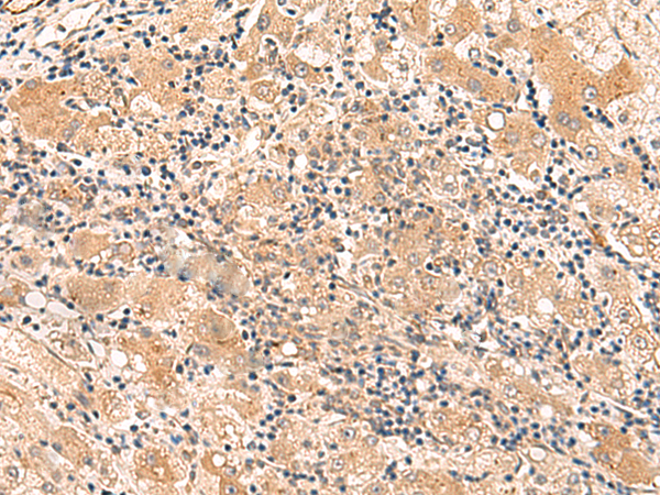 HPCA Antibody
