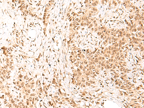 HIST1H1D Antibody