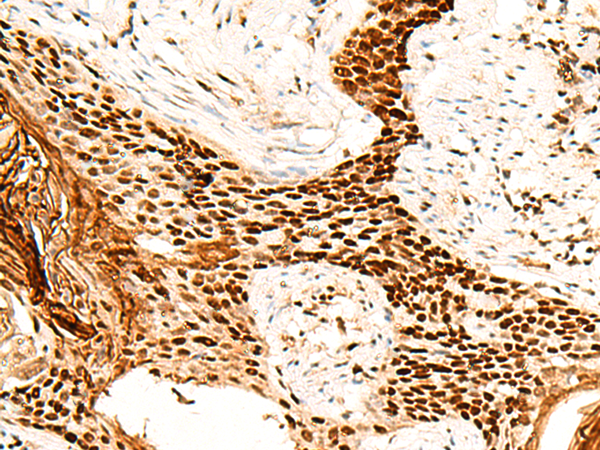 H1FX Antibody
