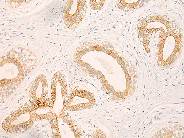 MTIF2 Antibody