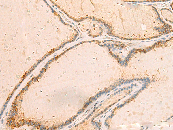 IP6K3 Antibody