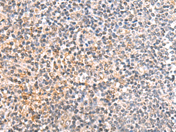 IL36B Antibody