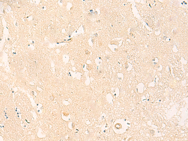 IL37 Antibody