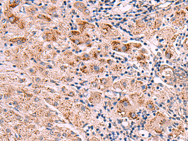 INPP5B Antibody