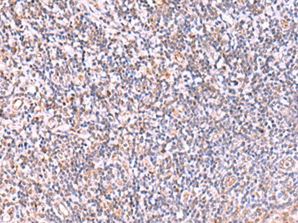 ITPKC Antibody
