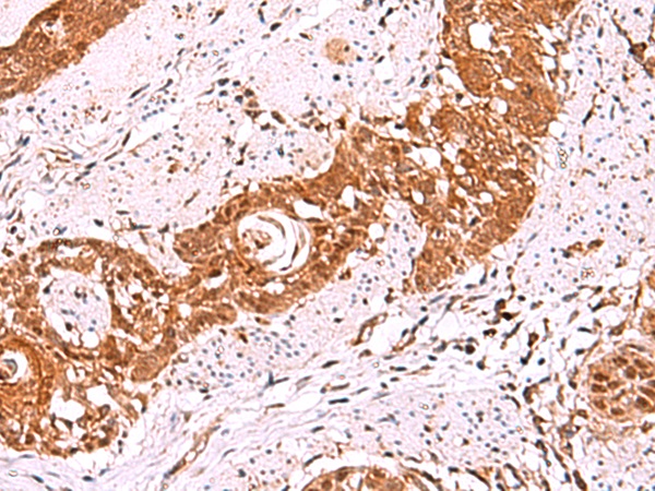 IRX5 Antibody