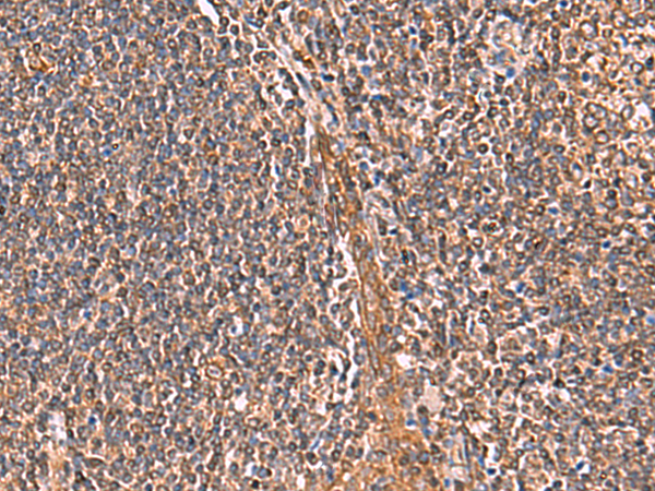 IFNA1/IFNA13 Antibody