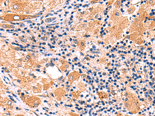 IFNA1/IFNA13 Antibody