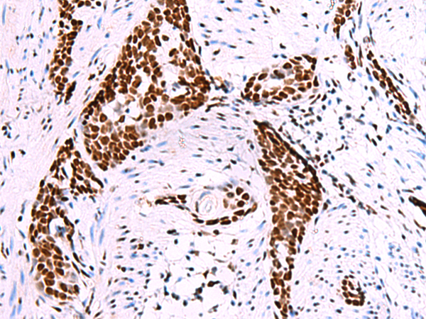 TRIM28(phospho-Ser824) Antibody