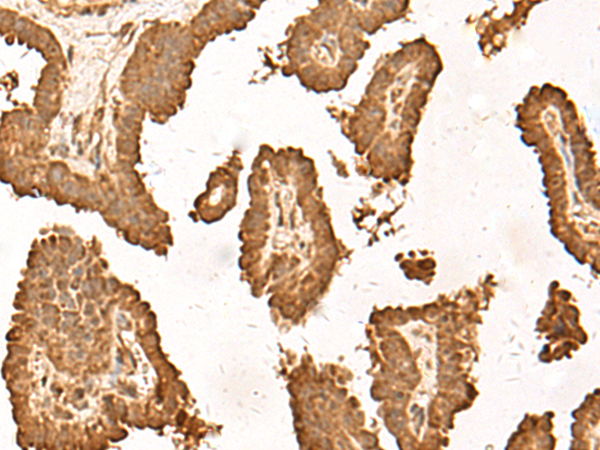 ZBTB43 Antibody