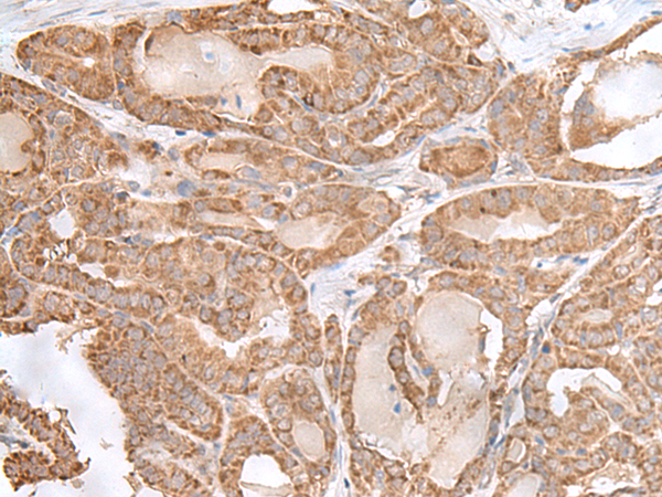 RPL28 Antibody