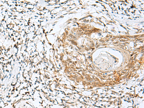NXNL1 Antibody