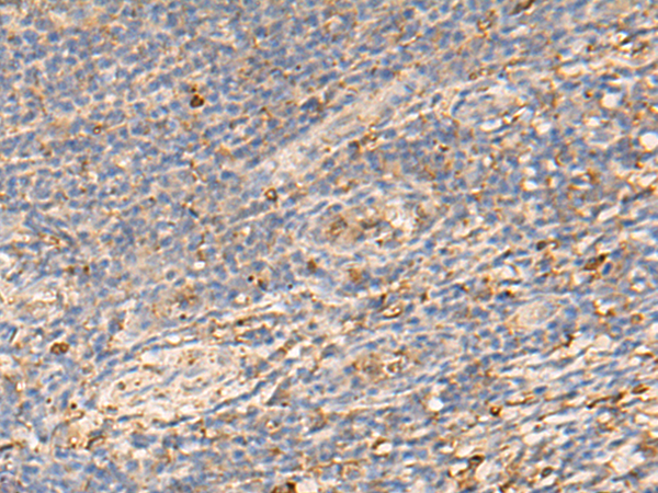 PDIA5 Antibody