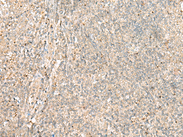 EIF2AK1 Antibody