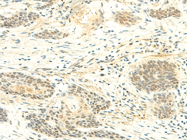 ATMIN Antibody