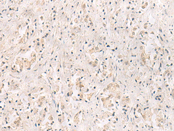 IL36RN Antibody