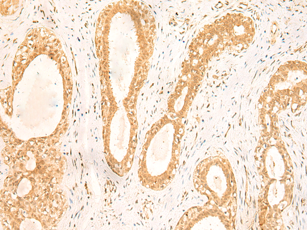 ST8SIA4 Antibody