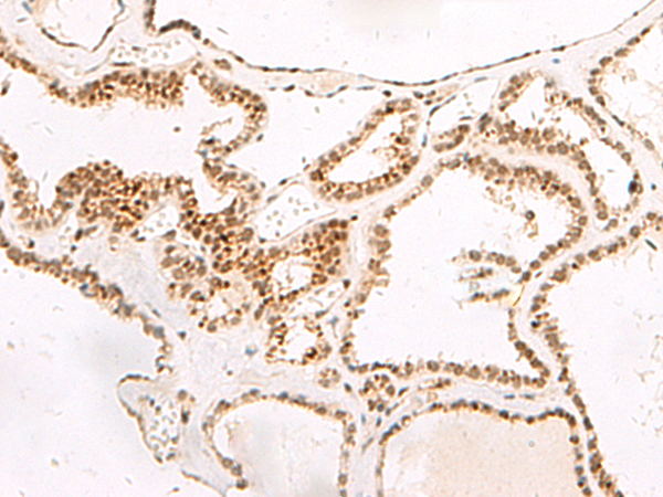 DGCR6L Antibody