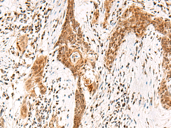 DGCR6L Antibody