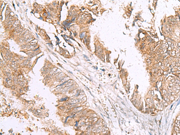 HLA-E Antibody