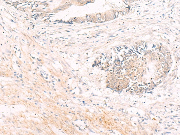 ADCYAP1 Antibody