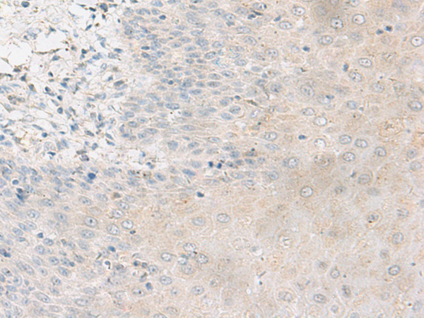 ELMO2 Antibody