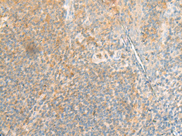 LAMTOR1 Antibody