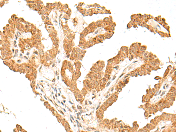 FANCB Antibody