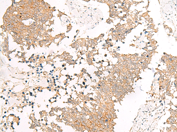 IZUMO1R Antibody