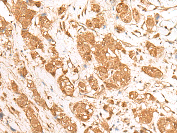 GANC Antibody