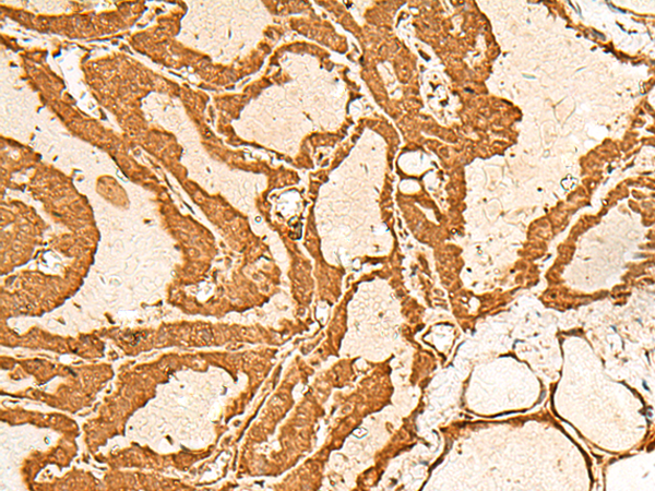 CHP1 Antibody