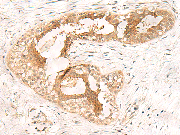 PHF2 Antibody