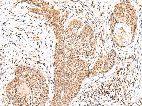 GRSF1 Antibody